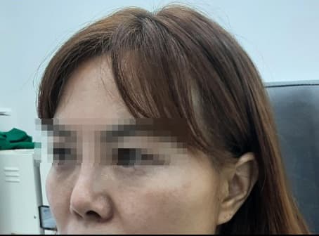 Beauty Stone Clinic — Case #2 — After