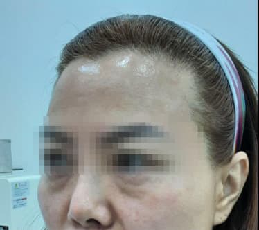 Beauty Stone Clinic — Case #2 — Before