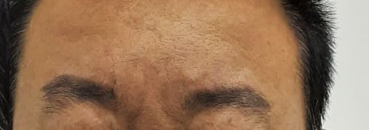 Beauty Stone Clinic — Case #3 — After