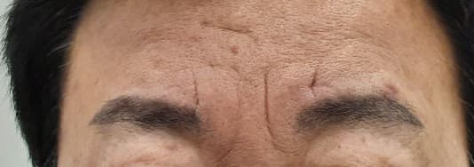 Beauty Stone Clinic — Case #3 — Before