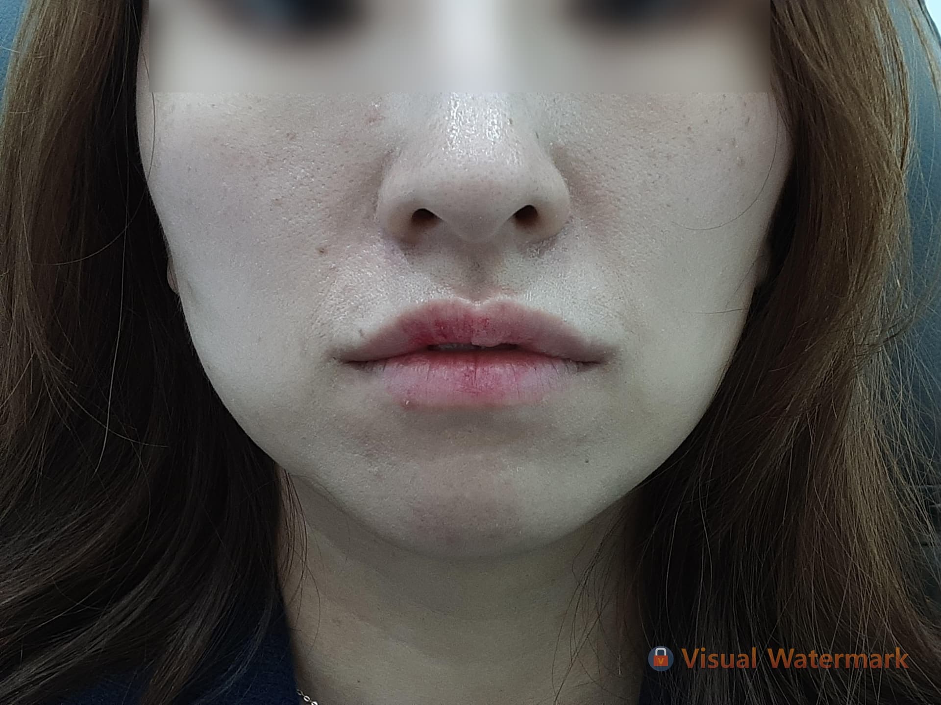 Beauty Stone Clinic — Case #4 — After