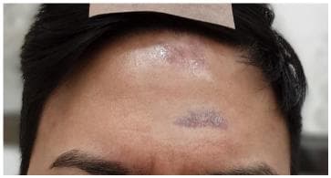 LIV Plastic Surgery — Case #10 — Before