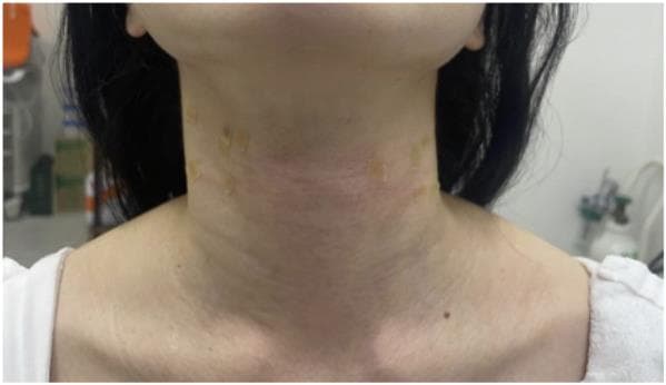 LIV Plastic Surgery — Case #20 — After