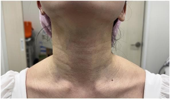 LIV Plastic Surgery — Case #20 — Before